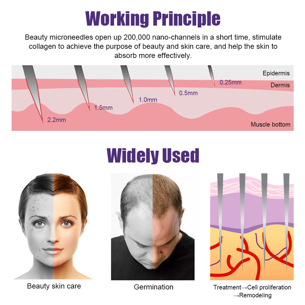 Natural Men Beard Growth Derma - Derma Roller 0.25 ulasan dan harga