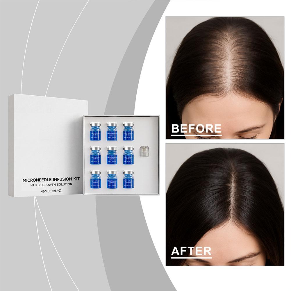 0.25mm Hair Essential Serum Mi - Derma Roller 0.25 ulasan dan harga